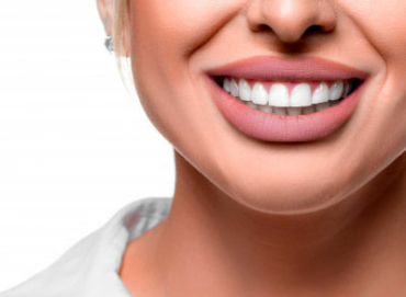 Blanqueamiento dental, tratamiento odontológico